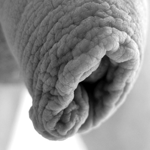 Foreskin details