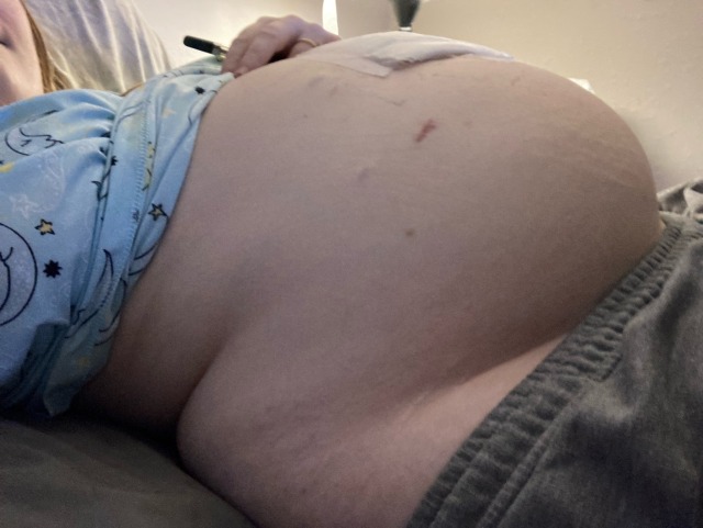 ffabellylover:Back home recovering but still feeling big and soft. I can’t wait until I’m fully recovered. Lately, I’ve been able to tolerate more food orally. Hoping this keeps up 😌 I rly want to get fatter 