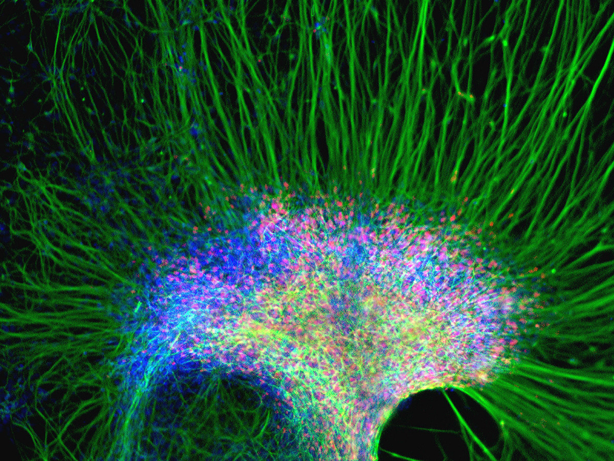 currentsinbiology:  A cluster of neural cells derived from human embryonic stem cells