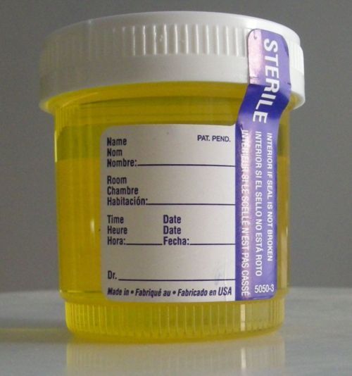Yellow Pee Tumblr Yellow Pee Tumblr