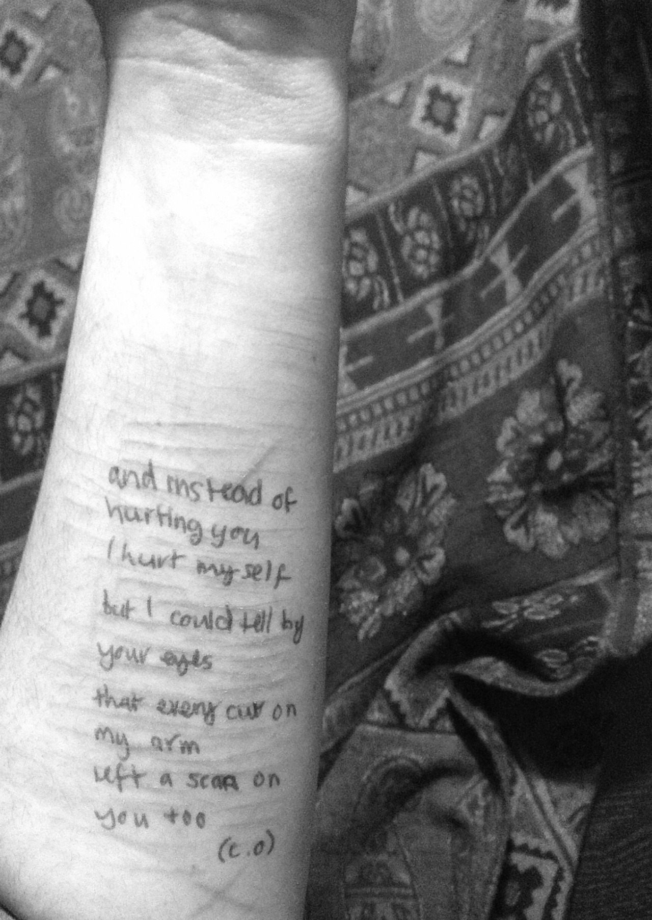 killing-caitlyn:  and instead of hurting you i hurt myself but i could tell by your