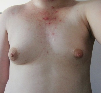 ourbreasts:  Hi, and thank you so much for this blog!  This is me, in all of my