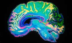 guardian:  Why modern life is making dementia in your 40s more likely | See full articleFrom background radiation to chemicals in the food chain, environmental  changes are contributing to a rapid global rise in neurological disease. A recent neurological