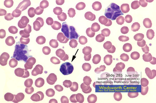 cerebriform nuclei