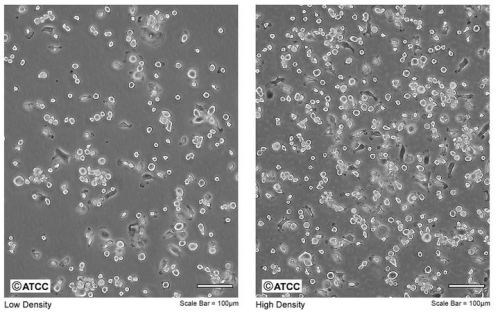 These are JawsII cells &ndash; immature dendritic cells that were derived from the bone marrow o