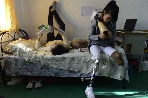 Double amputee girl (LBK RAK) from China - Ly In Sa ( 李应霞)