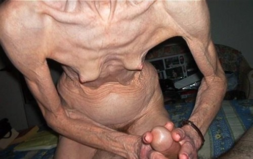 giovanni13fr:  anorexic …!…