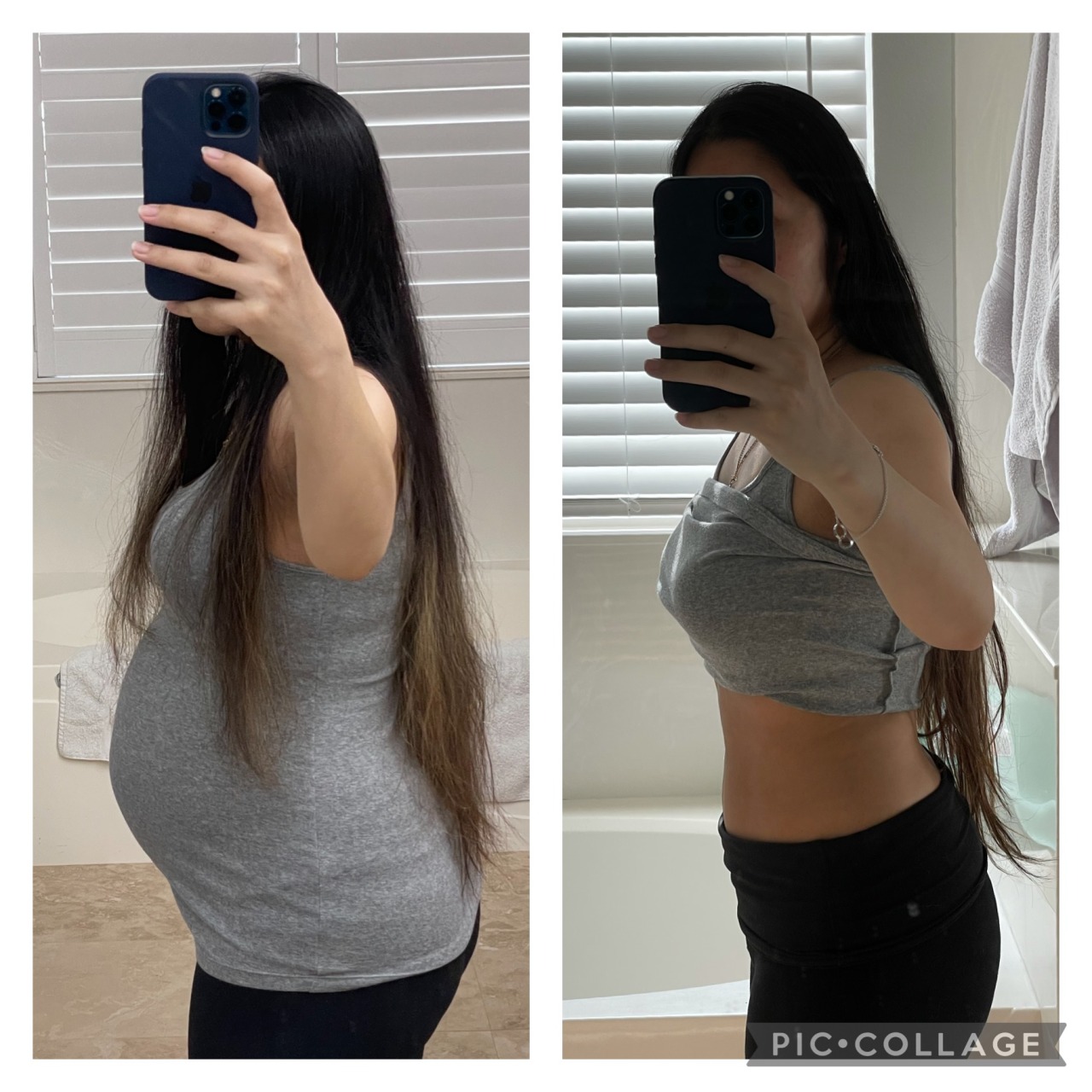 Before & After Photos – Belly Bandit