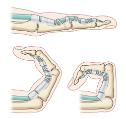 facts-i-just-made-up:  The process by which the penis becomes erect. Tragically beautiful. 