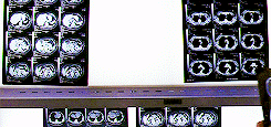 Imperfection Is Beautiful Medical Gif Hunt