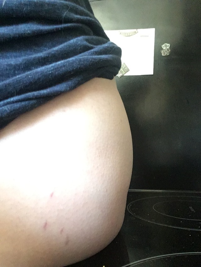 bigbellygirl321:What do you think~? Could I pass for pregnant~? Got so stuffed but couldn’t stop eating, sitting in a chair panting from eating too much 🥵 Also checkout my new stretch marks! They are small but it’s a start~ ☺️