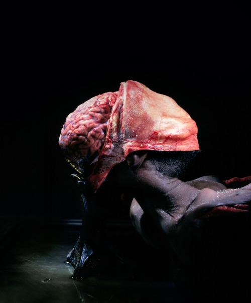 ether927:  Incredible photos from the operating room taken by Max Aguilera-Hellweg in his book The Sacred Heart, An Atlas Of The Body Seen Through Invasive Surgery, 1997, Bulfinch Press, Little Brown & Company, New York   https://www.behance.net/galle