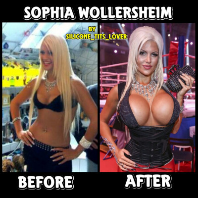 faketitfun:  Poll: Do you prefer the before or after version of Sophia?   Definetly