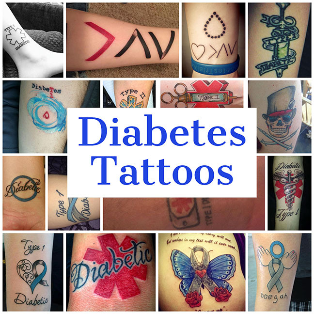 Temporary Diabetes Tattoo Type 1 Diabetic  Type W1N