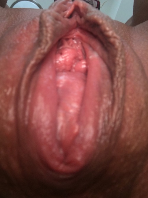 soonermagic1953:  Good god!! What a good looking gape! Hot!   great prolapsing cunt