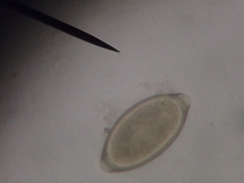 iheartvmt:
“ Whipworm (Trichuris vulpis) egg in a canine fecal flotation. 400x
”