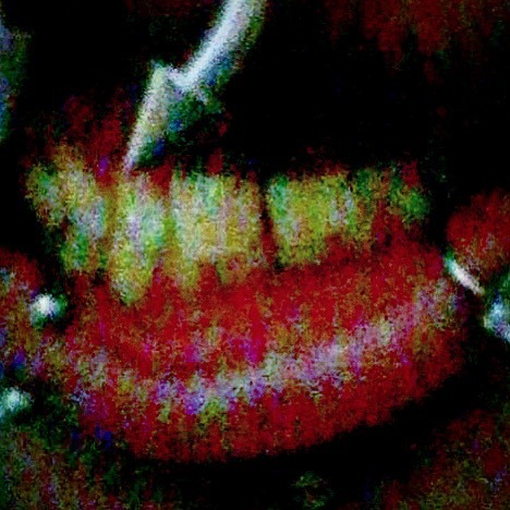 XXX “Yellow teeth are in.”-LOSt https://www.instagram.com/p/B8HOfDRlIji/?igshid=gt4z348p07zj photo