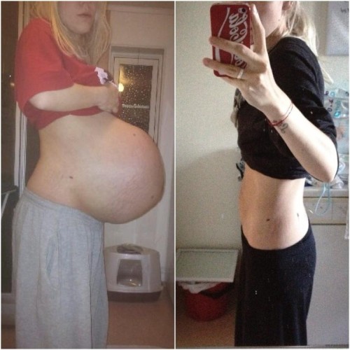 awellroundedwoman: I LOVE before and afters!