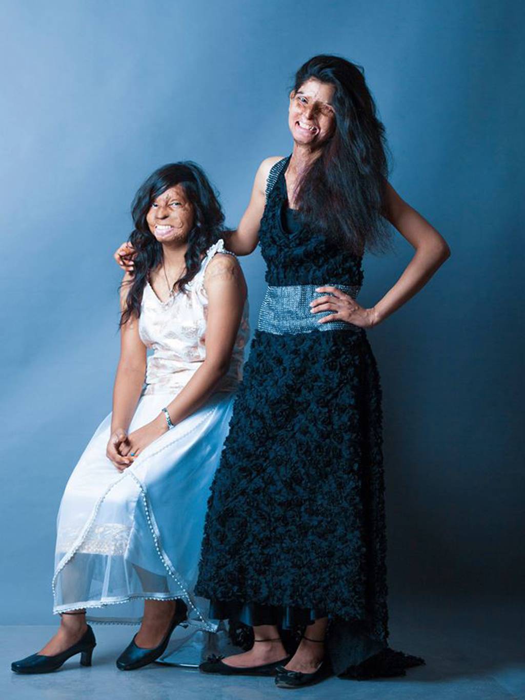 redsuelo:  amberrosehairline:  myvoicemyright:   Acid attack survivors in India model