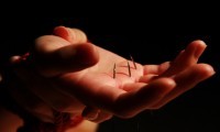 brokenandbought:  Not through the hand though, definitely. *shudders* I already know