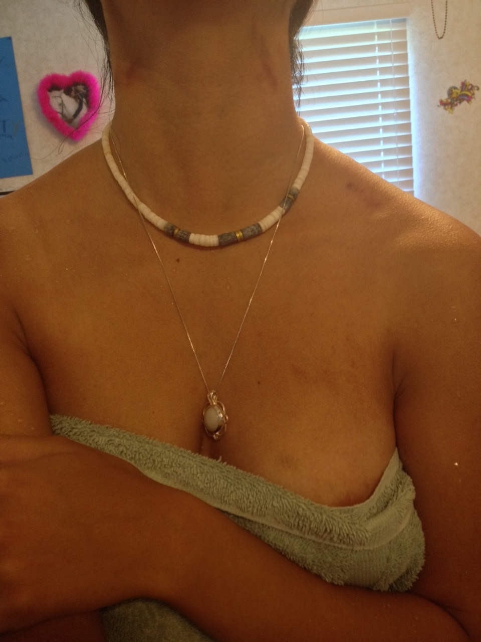 xrvdx:  Love having hickies again 