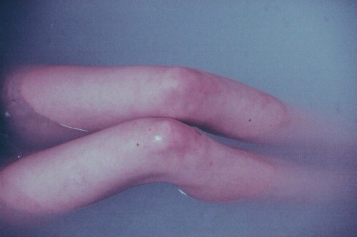 sick and tired of being sick and tired