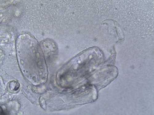 Ampelomyces quisqualis -hyperparasite fungus producing conidiospores (small spores) on its host fung