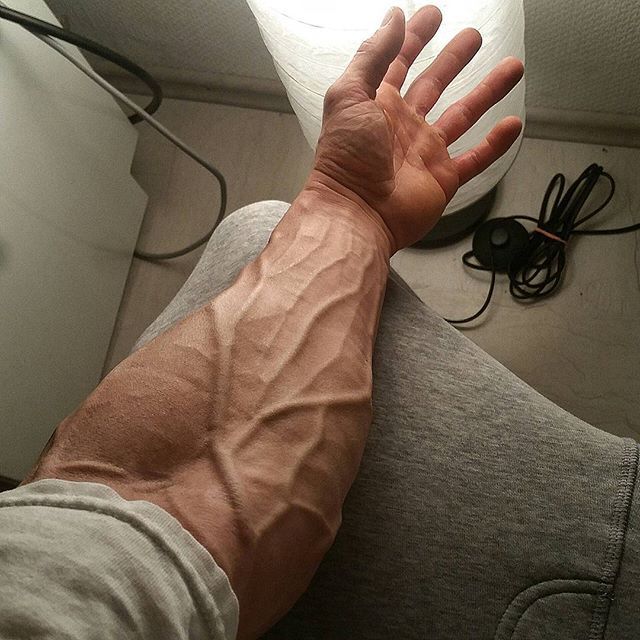 flex4mebigguy:  muscle-roids-y-bears:  after injection  Roll up that sleeve and show