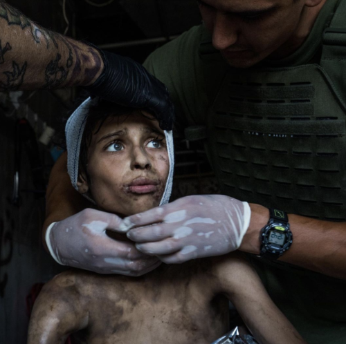 speciesbarocus:Thomas, an 11-year old Yazidi from Sinjar, Iraq, is treated at a  hospital in Mosul i