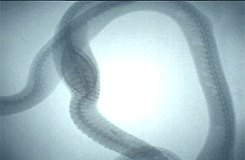 brainsx:  X-ray of a snake swallowing an egg 