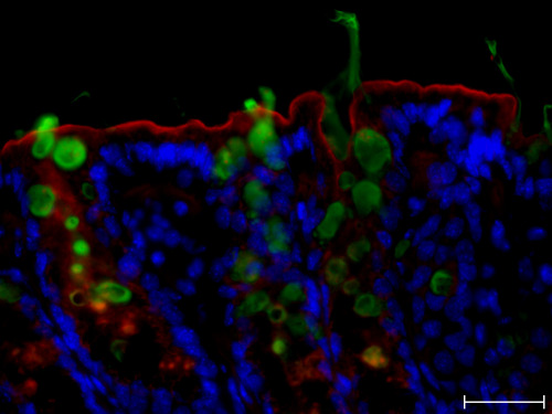bbsrc:  Research linking gut health, mucus and inflammatory bowel disease    These images show a mouse colon tissue stained for mucus (green), sugars (red) and cell nuclei (blue). The human colon, much like the mouse colon, is covered by a protective