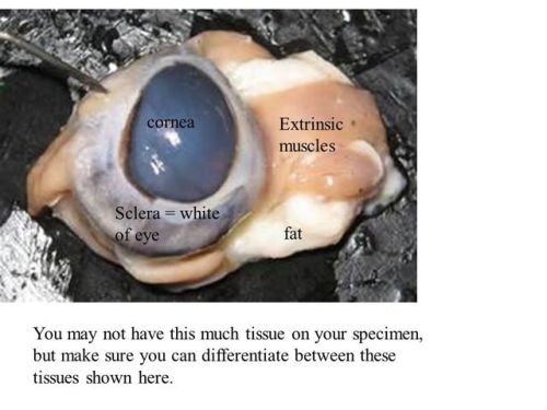 dissectio