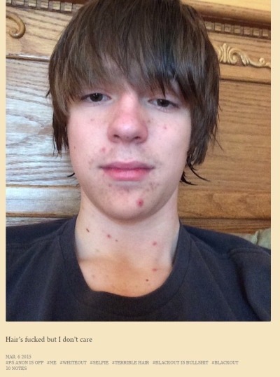 tokyotk:KJAHGDKJSFVKJGL;BKJOPREJB’W BM;LJGF I’M DEAD  christ kid. get those zits under control. 