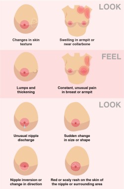 fuckyahumor: vaneloslash:  geekymedguru: How to spot signs and symptoms of Breast Cancer   Reblog to literally save a life  SIGNAL BOOST!!! 