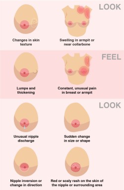 vaneloslash: geekymedguru: How to spot signs and symptoms of Breast Cancer   Reblog to literally save a life 