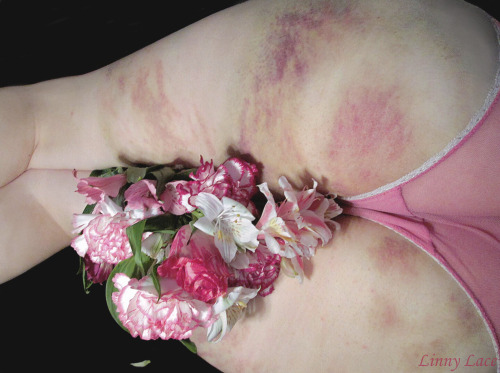 linnylace:Late Valentine’s Day post: this is easily becoming one of my favorite bruise-related photosets. The flowers were picked out specifically with my bruise colors in mind ♡  