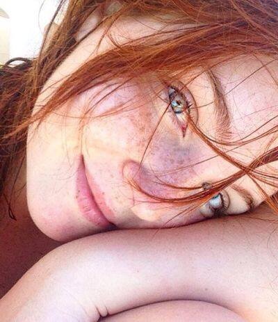 yesgingerfriend: Feine Sommersprossen .