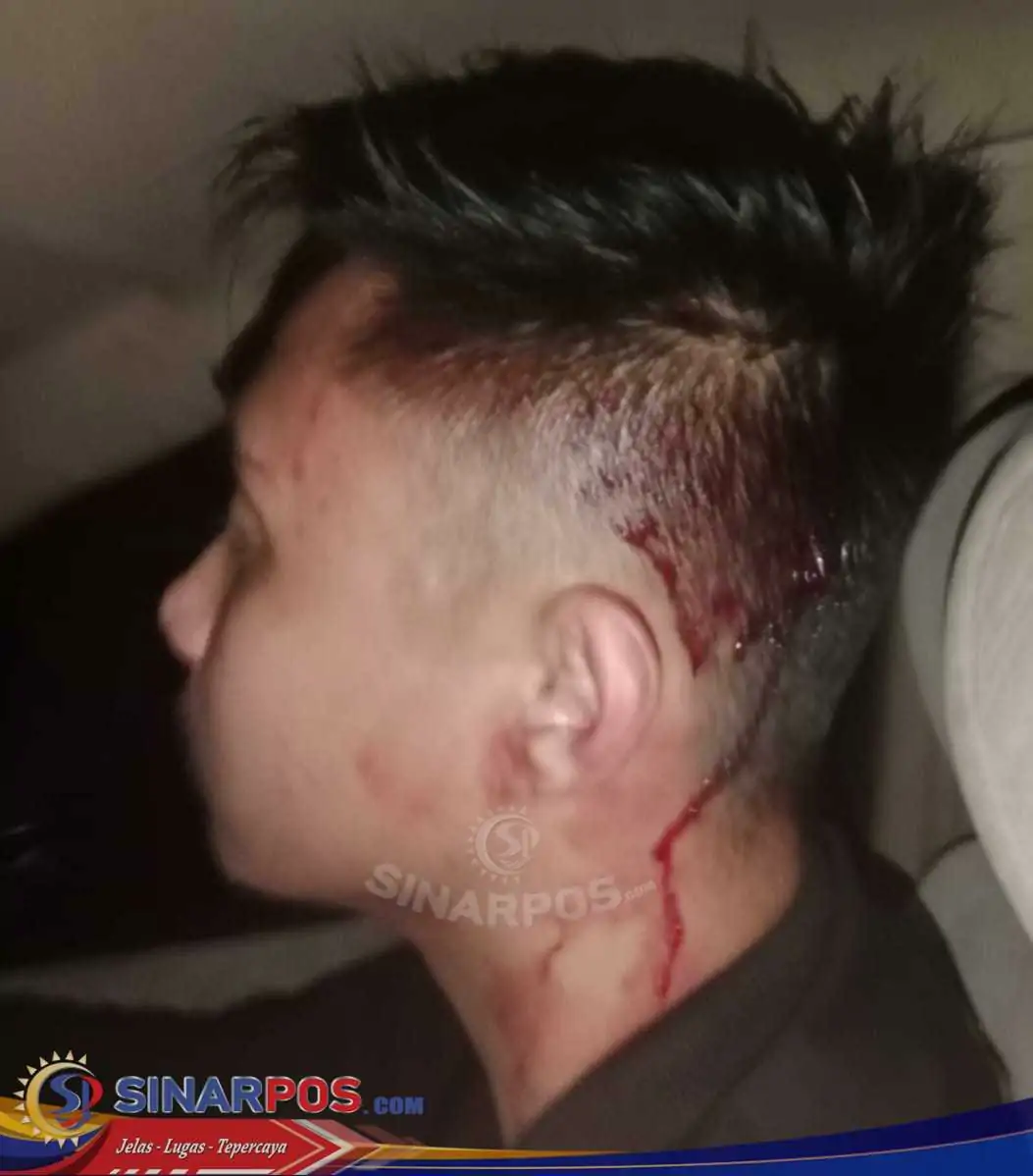 2 Orang Pengurus FWJ Indonesia Korwil Kuningan Dikeroyok 15 Orang Ngaku Ormas Al Jabar