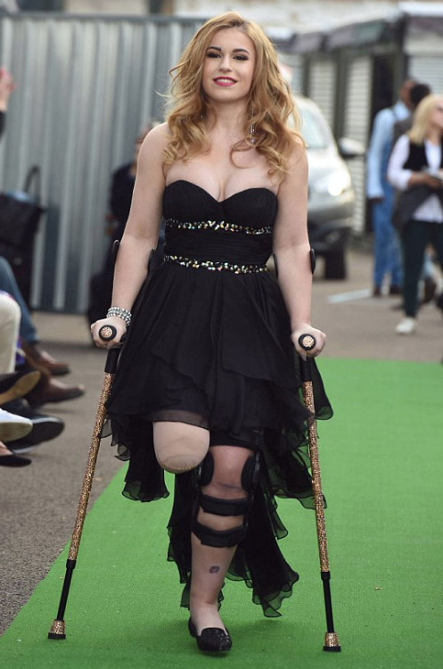 Lost her leg in the Alton Towers crash.  She made her catwalk debut at a Models of Diversity show