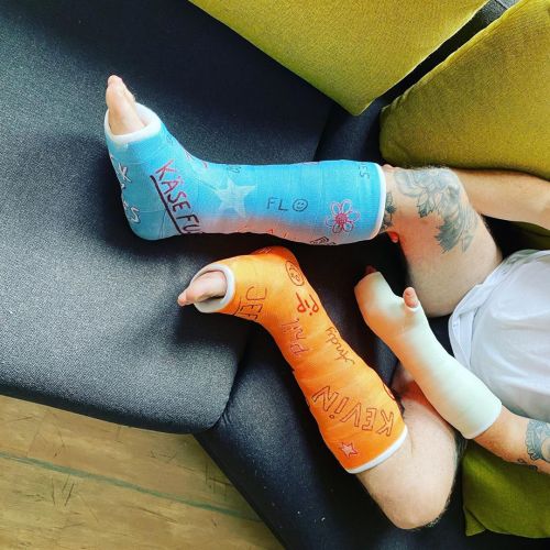 #brokenleg#gipsbein#rollstuhl#wheelchair#smellyfeet https://www.instagram.com/p/CF1r1TlJ4CqSNzQ3WU_H