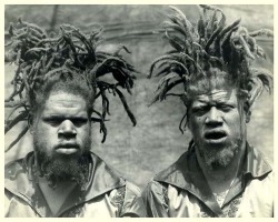 rudegyalchina: tgmozley:  mixedfreckle:  1899 Willie and George Muse were kidnapped from their rural Virginia home, sold and put to work as attractions in various “Freak” and Carnival shows.  At the time black albinos were very rare to see so they