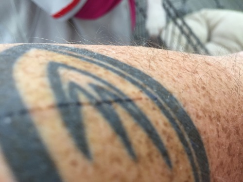 This Is What A Difference Aquaphor Does For You If You Have A Cut. Took Me A Week To Heal A Cut I Had