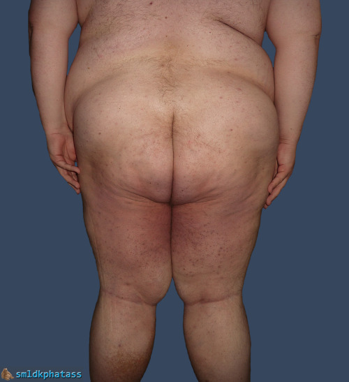 smldkphatass:  Fat ass. »» smldkphatass »»  Home | Archive | About | Follow 