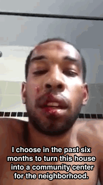 Porn huffingtonpost:  Ronald Moon Jr., Man Beaten photos