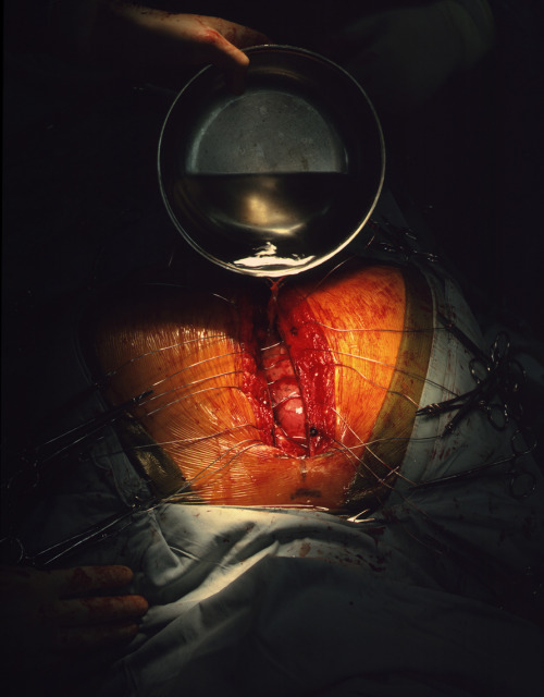 ether927:  Incredible photos from the operating room taken by Max Aguilera-Hellweg in his book The Sacred Heart, An Atlas Of The Body Seen Through Invasive Surgery, 1997, Bulfinch Press, Little Brown & Company, New York   https://www.behance.net/galle