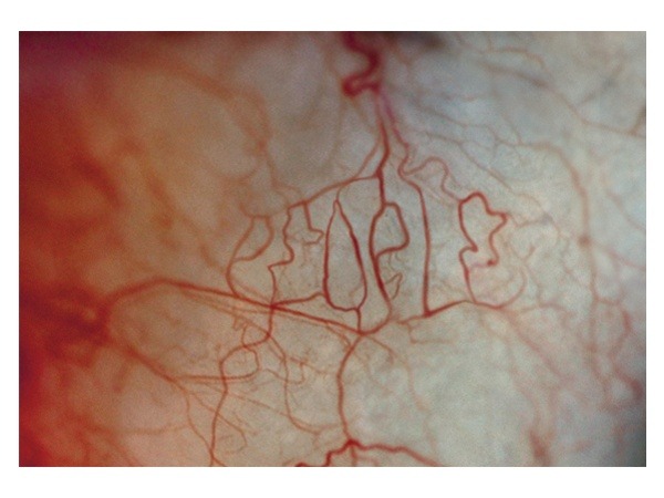 vanished:  Peter Chmela - Don’t Judge People According To Their Appearance, 2009