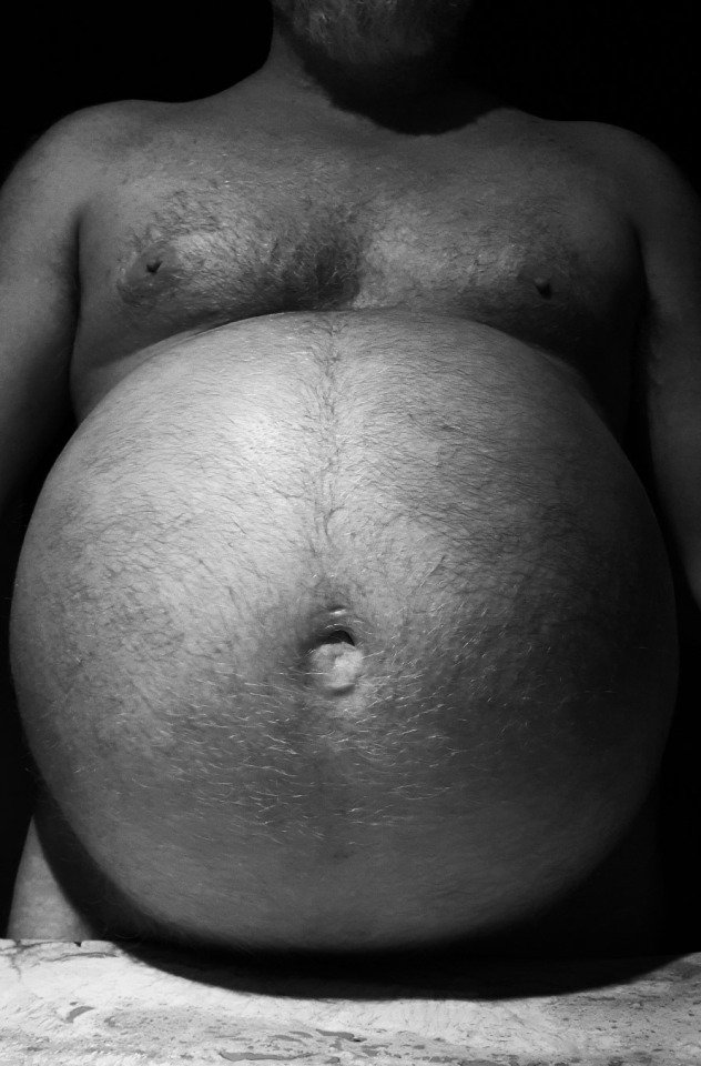 unicorn-ballbelly: