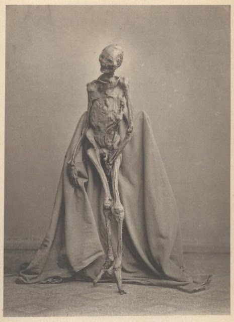 theoddcollection:Photograph of the “Rendswühren Man”. A bog body found in 1871 in the “Heidmoor” nea