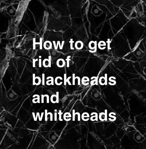 queenblogsz:Causes of blackheads and whiteheads: blackheads r caused when sebum and dead skin cells 