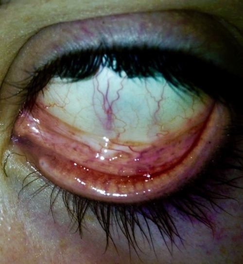 https://hacerme-insensible.tumblr.com/post/115759640019